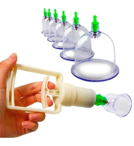 Kit Hijama 6 pièces (Cupping Therapy)